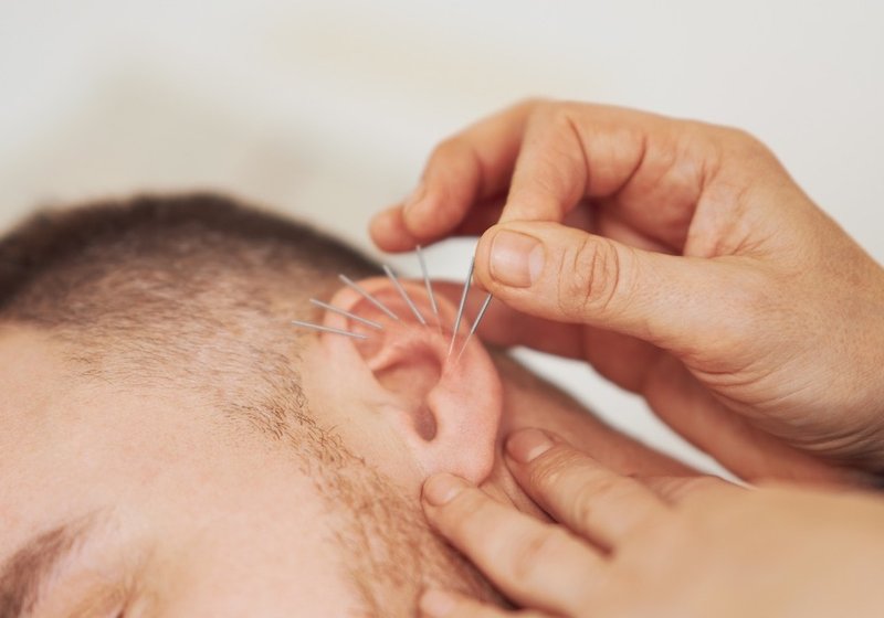 иглоукалывание от курения