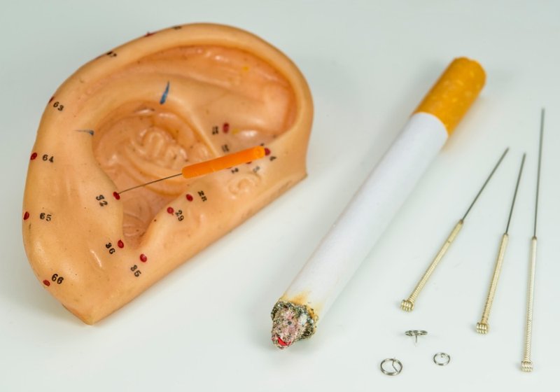 Иглоукалывание от курения