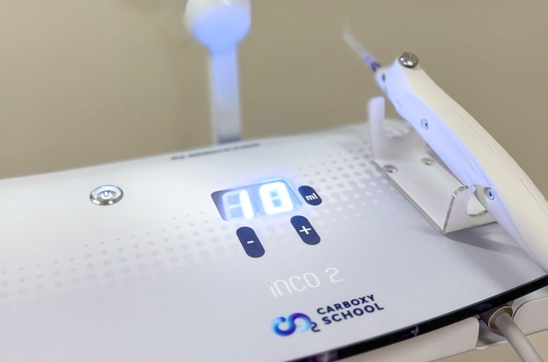 Карбокситерапия