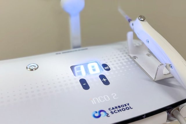 карбокситерапия