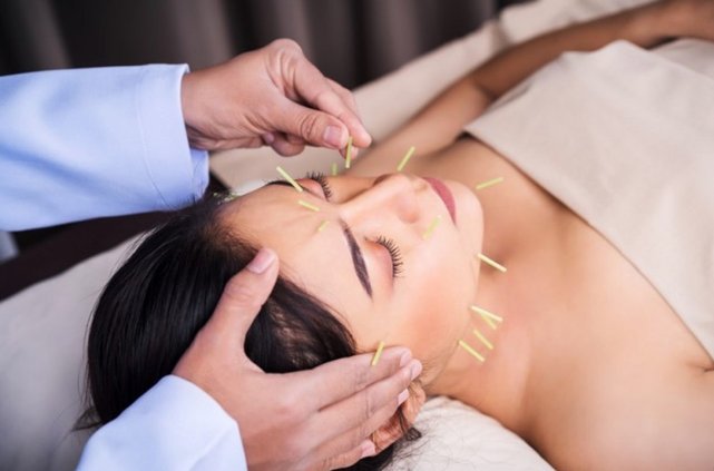 неврит лицевого нерва