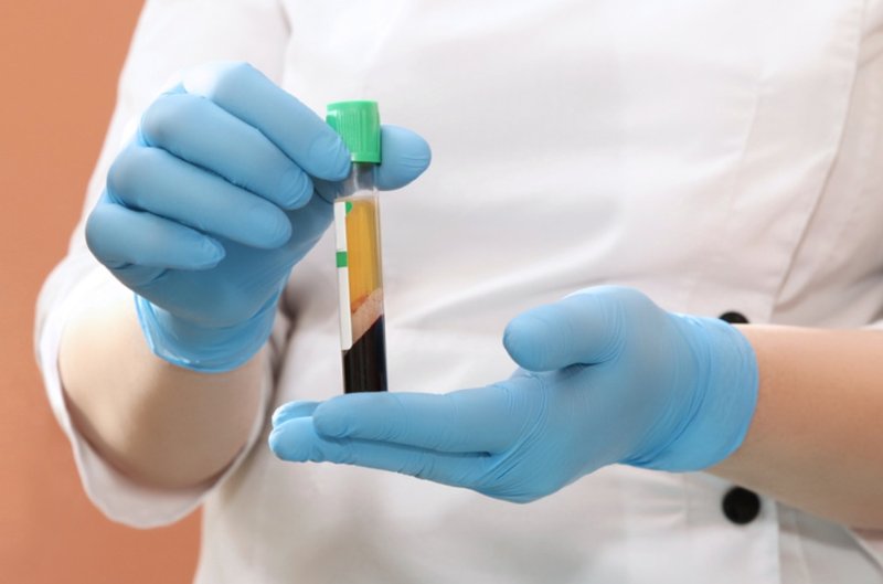 Плазмотерапия